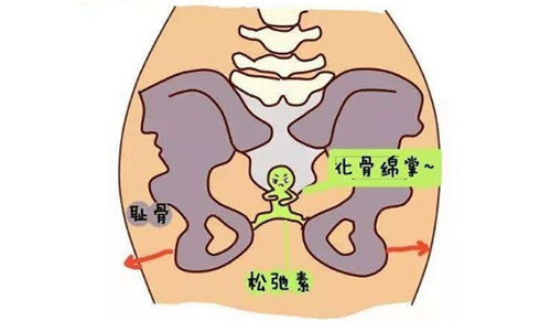 骨盆修复图片