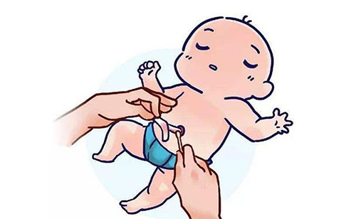 婴儿肚脐照顾图片