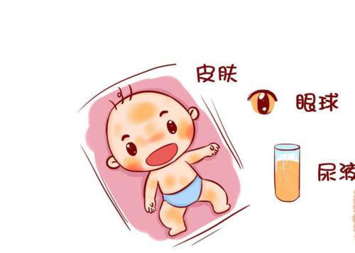 新生儿的黄疸现象