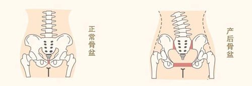 产前骨盆和产后骨盆区别