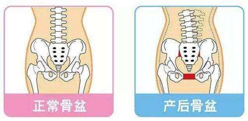 正常骨盆与产后骨盆