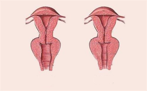 女性阴道松弛和紧致对比.jpg
