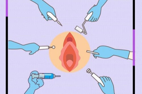 私密整形卡通图.jpg