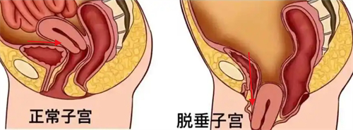 产前产后子宫状态