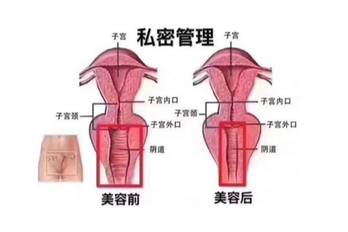 子宫概念图.jpg