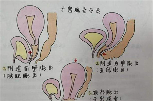 产后修复到底要不要做？这些项目真的不能省价格不贵很重要！