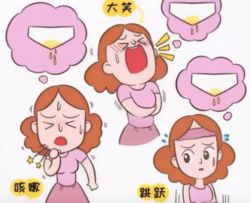 产后大笑漏尿示意图