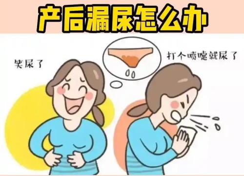 产后漏尿漏尿怎么办