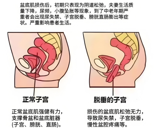盆底肌介绍图.jpg