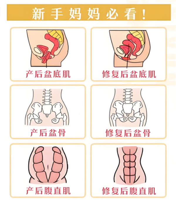 产后修复项目展示.jpg