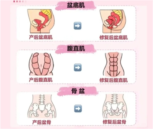 产后修复要做的项目.jpg