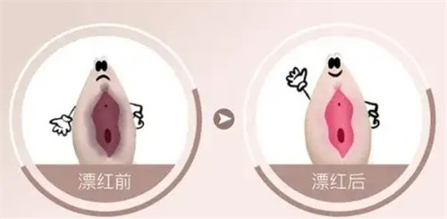 私密漂红前后.jpg