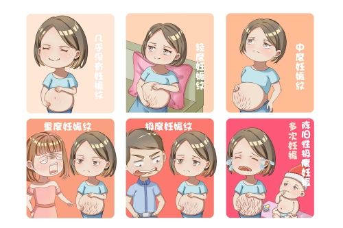 产后修复必做的项目有哪些?多数妈妈都适用:盆底肌/腹直肌分离/骨盆前倾需评估再行动