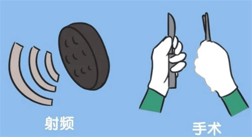 阴道紧缩有射频和手术多种方式.jpg