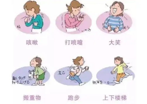 盆底肌松弛示意图