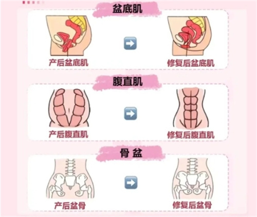 产后修复的三个黄金期千万别错过！抓住这几个月结果翻倍，修养更快更轻松！
