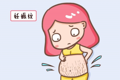 妊娠纹卡通图