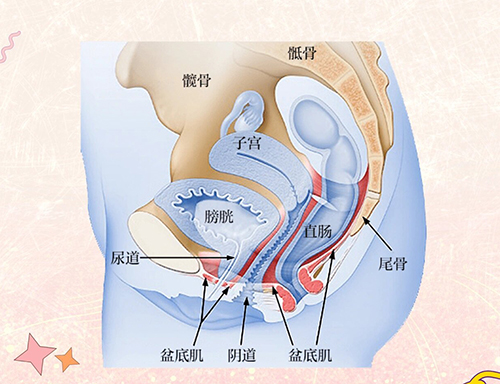 盆底肌修复漫画示意图