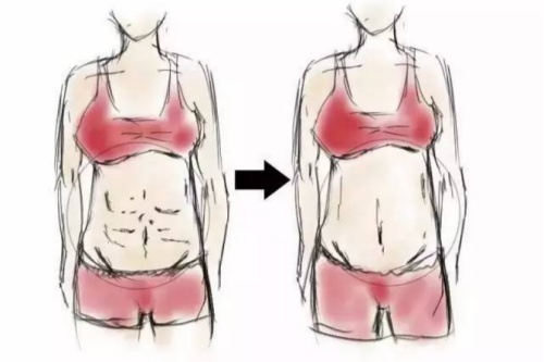 生完孩子多久能做腹部整形？医师揭秘更佳时间，助你快速修养孕前身材！