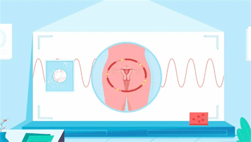 私密紧致卡通图