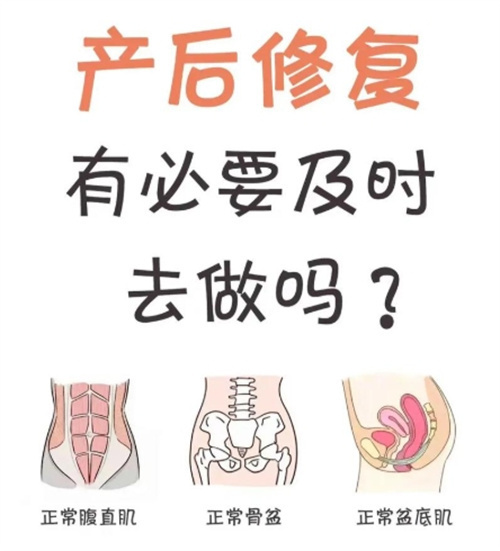 产后修复肚子会变小吗？大部分人可改善，但需针对性修复