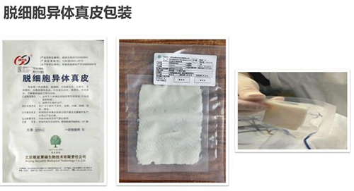 3d生物束带紧缩术材料包装示意图