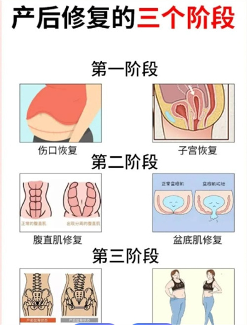 顺产 / 剖腹产产后改善差异：4 大核心项目 + 时间节点，新手妈妈必看